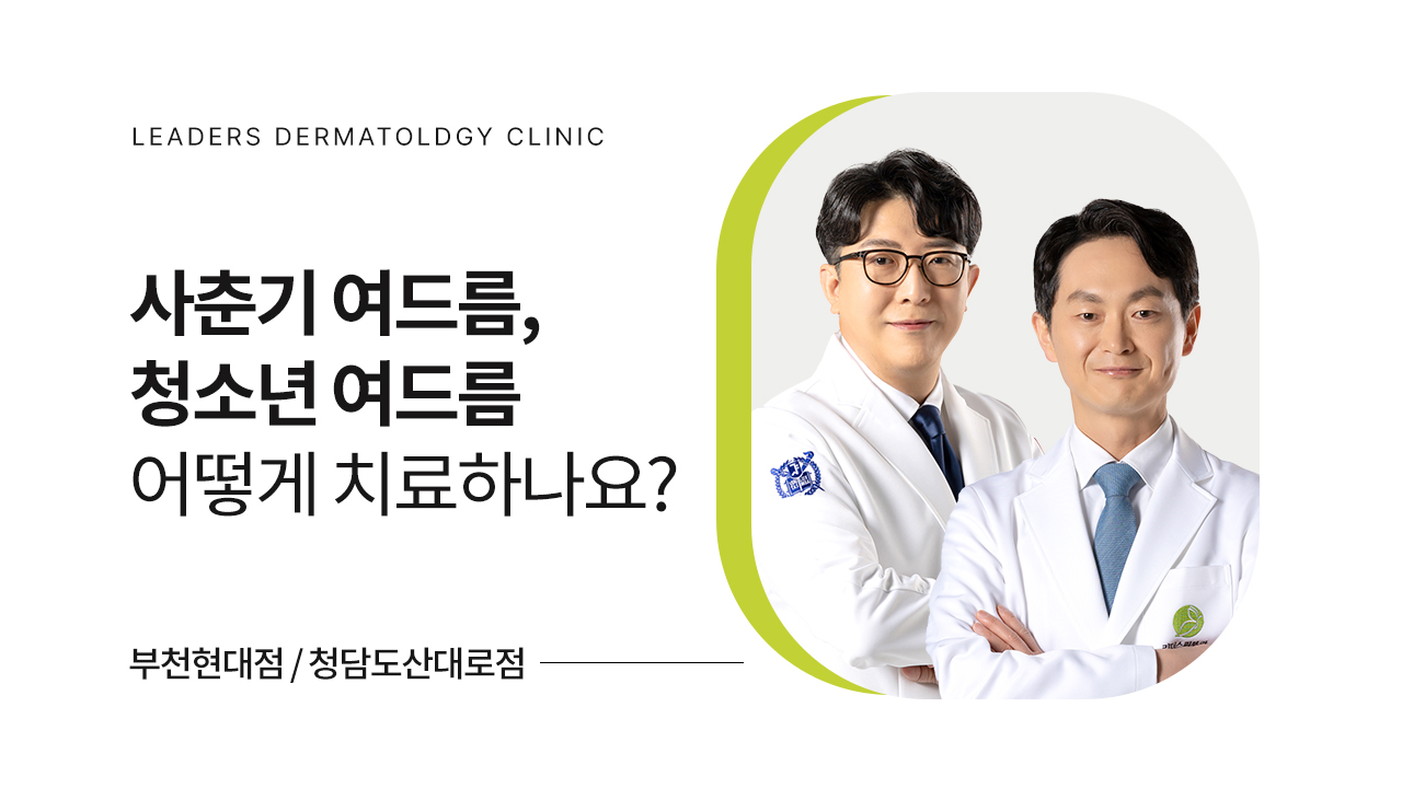 사춘기 여드름, 청소년 여드름 어떻게 치료하나요?