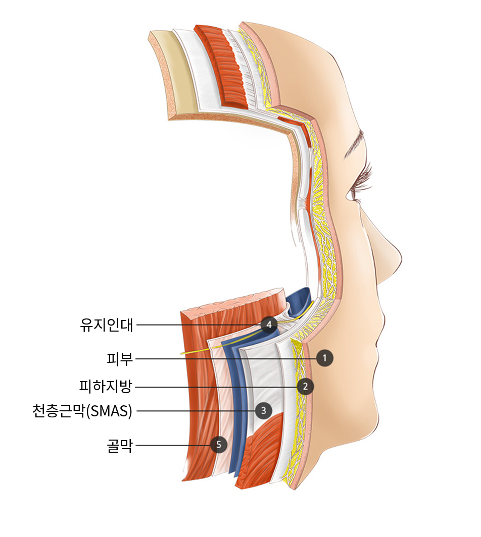 피부층